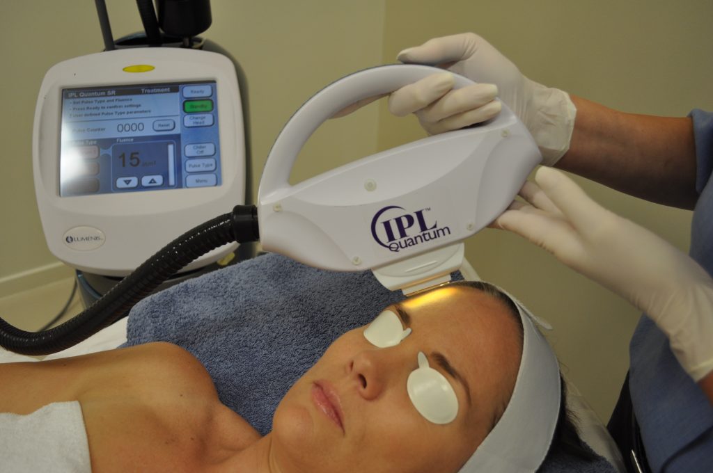 IPL Photorejuvenation Face Treatment